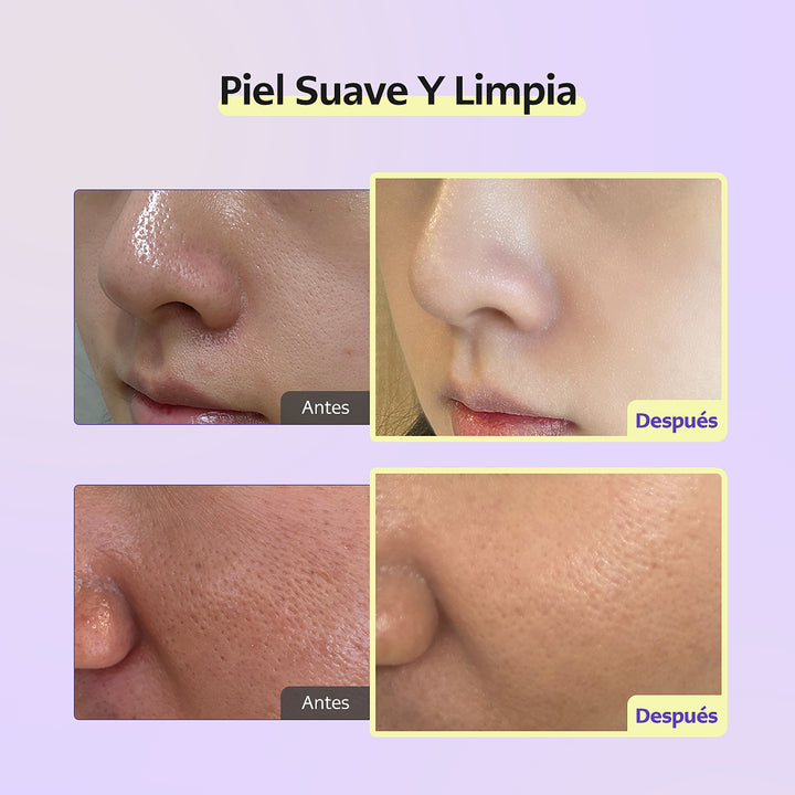 🚀 Cellology Purple Carrot Pore Ampoule 30mL - imagen 3